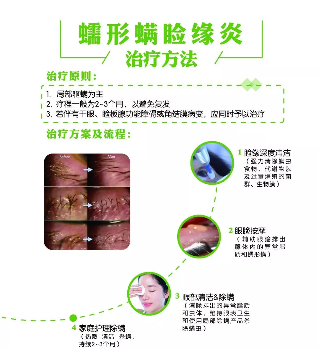 睫毛上竟然爬出5条螨虫,快来给眼睛做个螨虫检查!