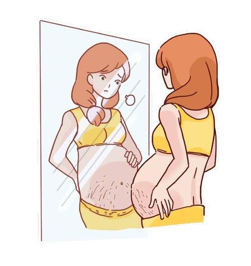 孕期出现妊娠纹怎么办，三招教孕妇快速去除孕期妊娠纹
