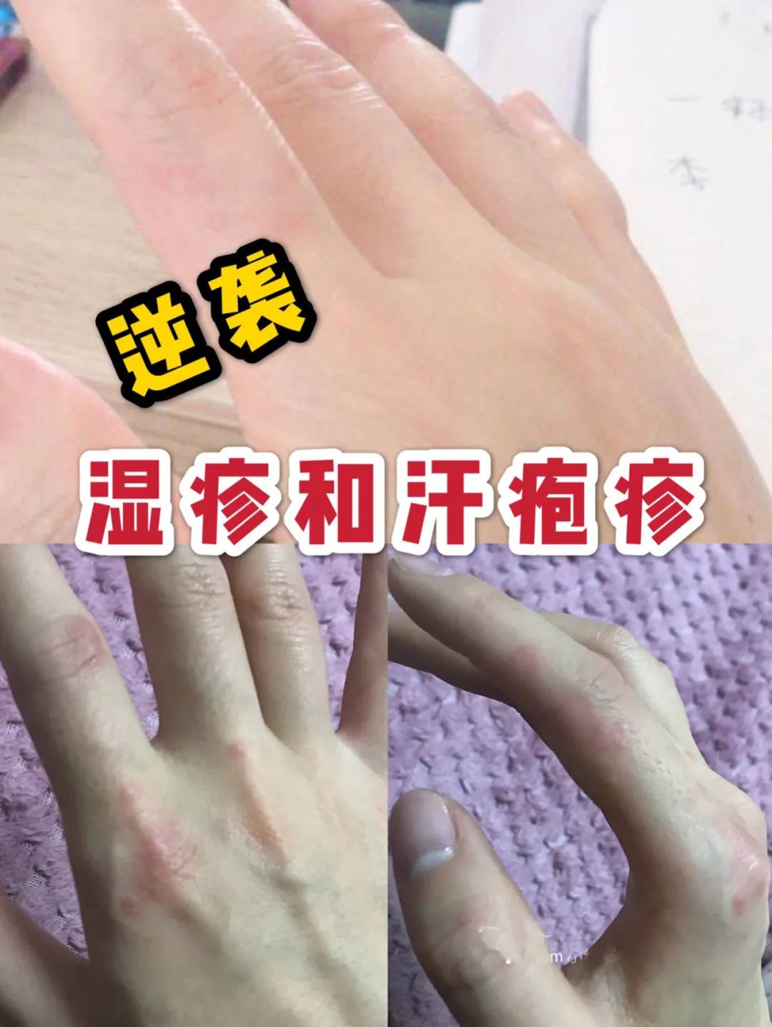 e970a37d50d2490db43ee79f64ce859e.jpeg