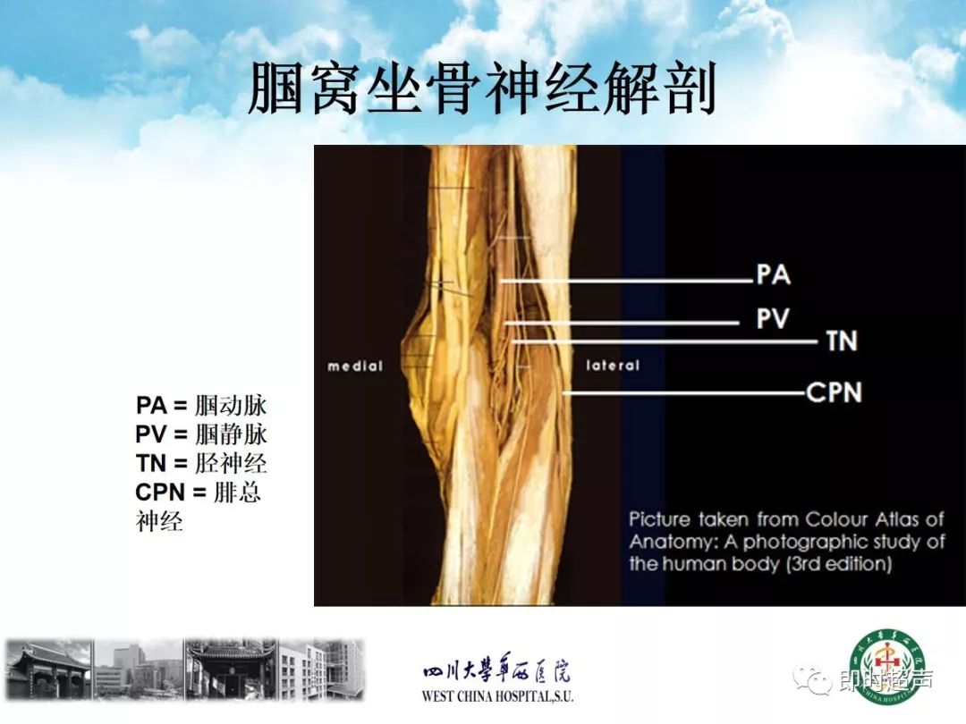 超声引导下股神经坐骨神经阻滞