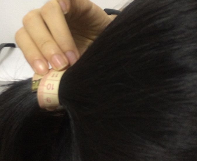 可生发际线是什么原理_你有什么可豪横的图片(3)