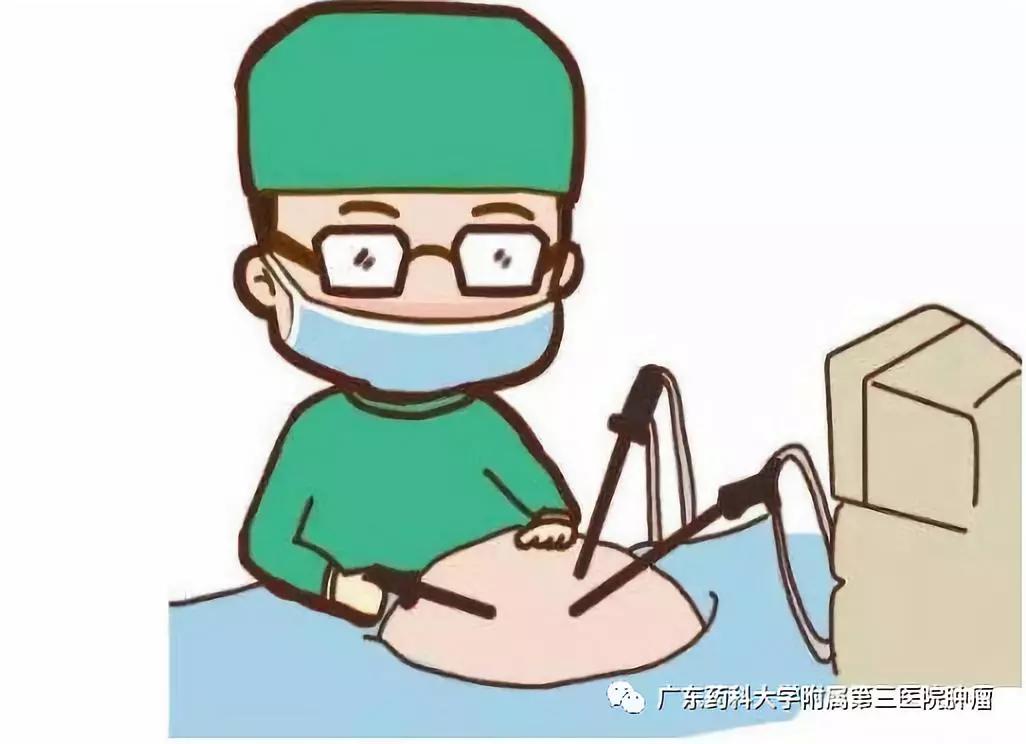 微创消融手术的风险大吗?