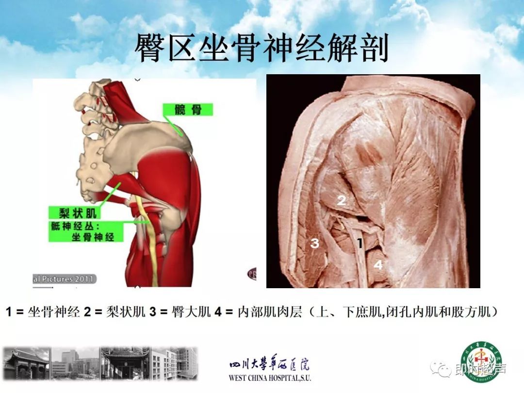 超声引导下股神经坐骨神经阻滞