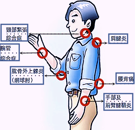 肌肉劳损怎么办