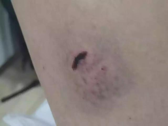 狗身上的伤口怎么处理 cf4f0d250a80402cbbb4fb9243a66730.jpeg