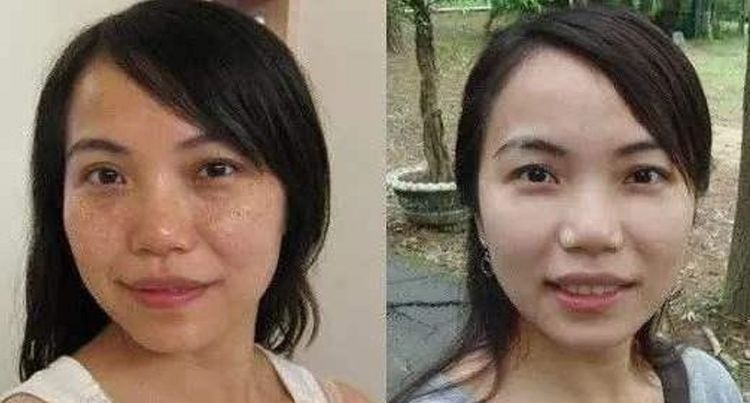 斑什么陆成语_蛇斑疮是什么症状图片