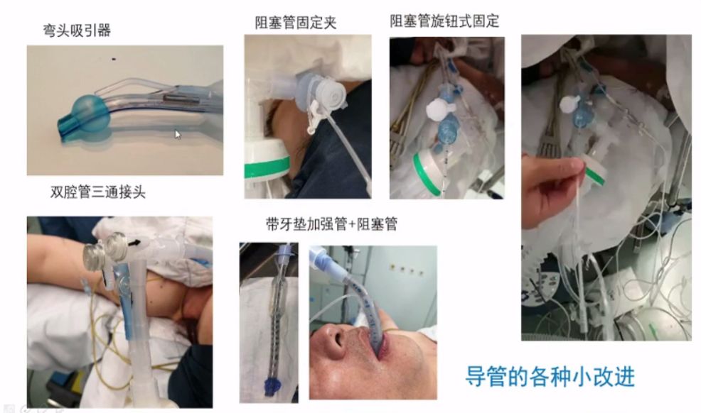 wire-guided endobronchial blocker·视频阻塞=视频单腔管 支气管