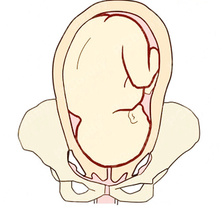 脊柱前弯,四肢屈曲交叉于胸腹前的状态,医学上称为枕前位(即正常胎位