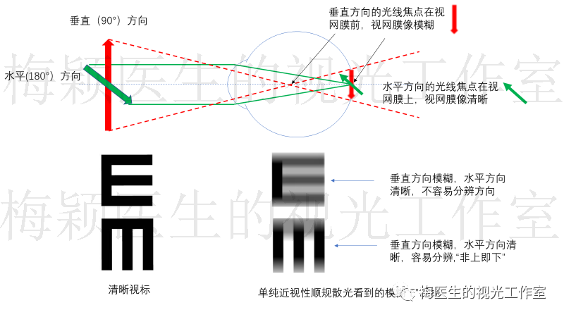 散光300度,视力0.8,看得清楚为什么要戴眼镜?