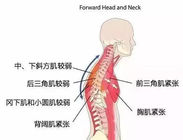 弯腰怎么办