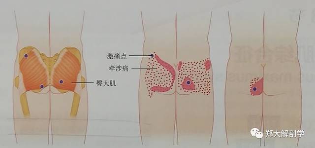 六种引起骨盆的疼痛综合征