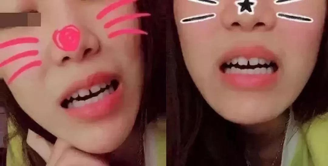 2  @一只佩奇 25岁 我的牙齿小小的,白白的 最大的缺点就是门牙的缝隙