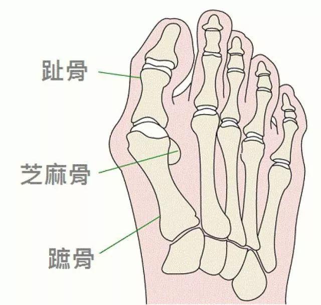 跑步时大脚趾疼怎么办?