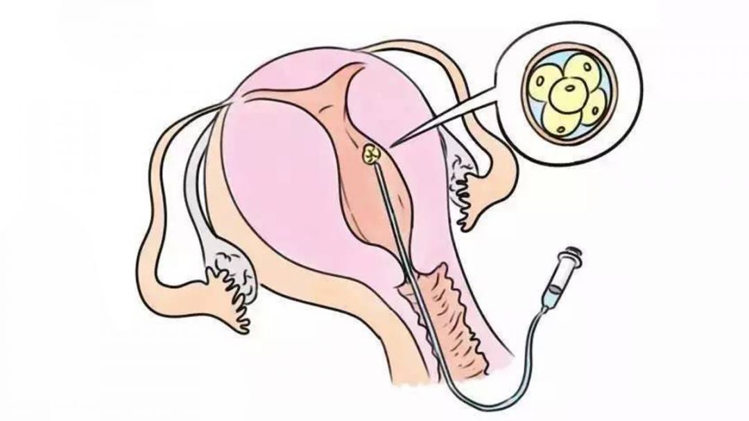 他们自称月老让精子和卵子相亲的那种不信看视频