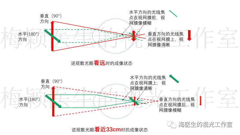 散光300度,视力0.8,看得清楚为什么要戴眼镜?