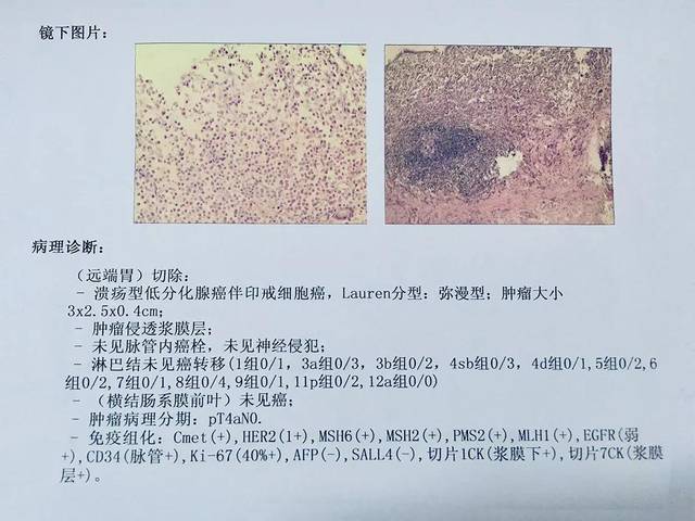 ""病理报告写的是老年疣,又有人说这是基底细胞乳头状瘤,到底哪个是对