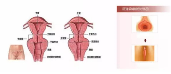 什么是私密为什么做私密 b1b891832cad4b06bed99c0c990531fd.png