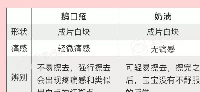 宝妈们懂得如何判断鹅口疮,随之,治疗就成了宝妈要知道闹重点.