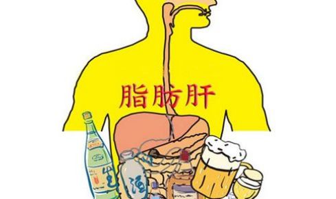 酒精肝什么症状 f0a04395aa544292aff417c806eb77a9.jpeg