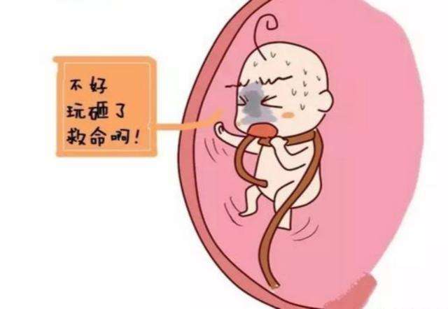 几个月出现脐带绕颈 0fc64dc90e344614aba20888a72b07ee.jpeg