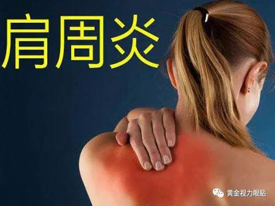肩周炎发作起来痛痛痛,教你一套展筋操,缓解肩周炎!
