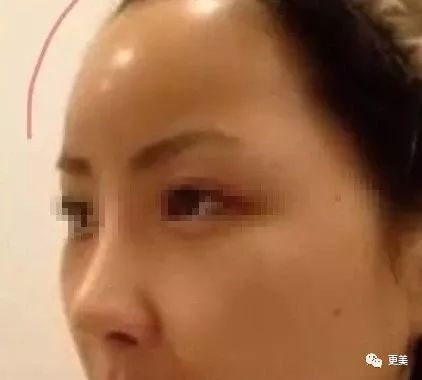 1c192c50d63345b9bd8f2c92e4c98fcf.jpeg
