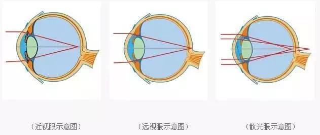 近视可以不老花老花可以抵近视