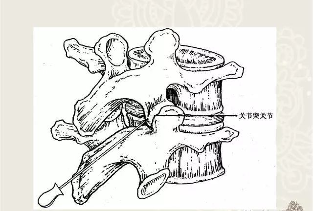 腰椎棘突在针刀定位治疗中的应用