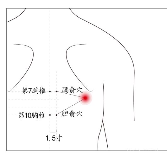 艾灸治好胆结石的原理_胆结石可怕吗 艾灸能把胆结石灸成泥沙状