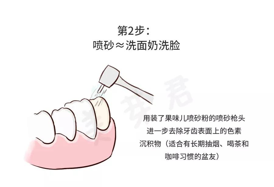 伢典科普洗牙全攻略——史上最全的洗牙介绍和问答集锦 搜狐大视野 搜狐新闻 