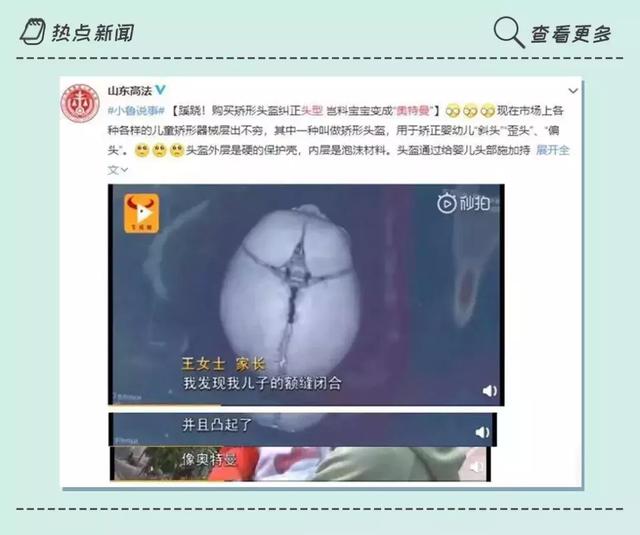 科学家庭育儿@原创脸不对称、视听障碍......多重视宝宝头型吧，时间很紧张