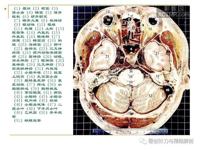 人体断层解剖图谱