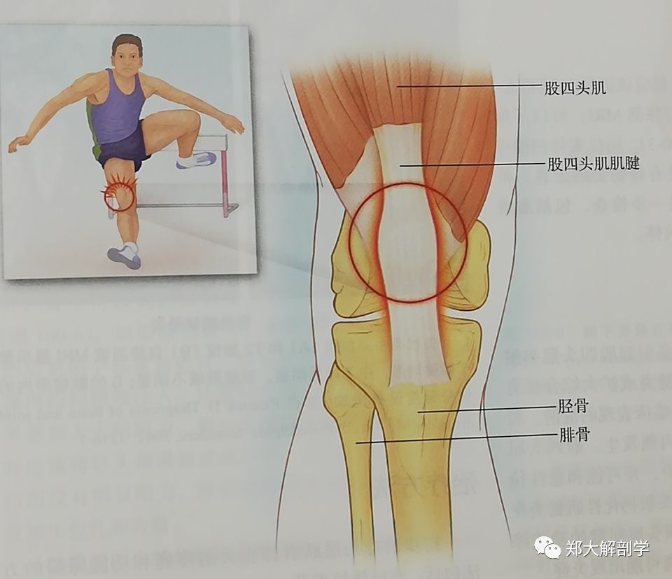 八种引起膝关节的疼痛综合征Ⅰ_韧带