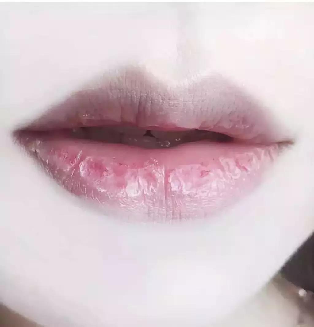 成语唇什么连_成语故事简笔画(3)