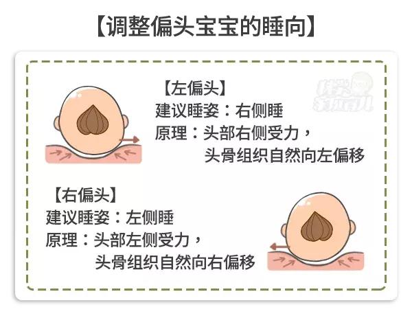 科学家庭育儿@原创脸不对称、视听障碍......多重视宝宝头型吧，时间很紧张