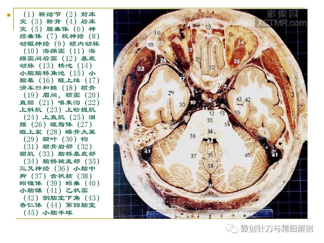 人体断层解剖图谱