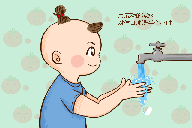 【西红柿妈咪】原创娃被烫伤，是先冲水还是脱衣服？家长要这样做，别因无知害了孩子