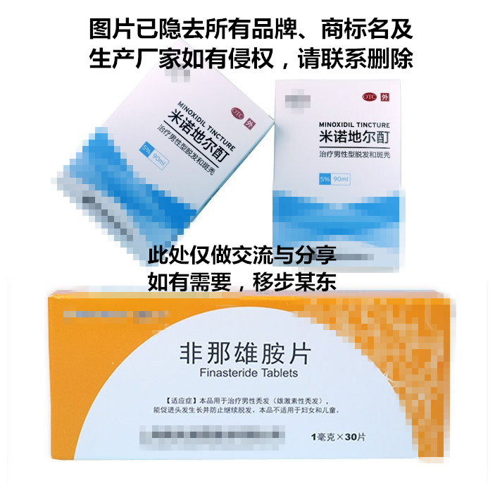 发迹米诺地尔酊这4种行为会导致脱发提前特别是第2条很多人都不知道