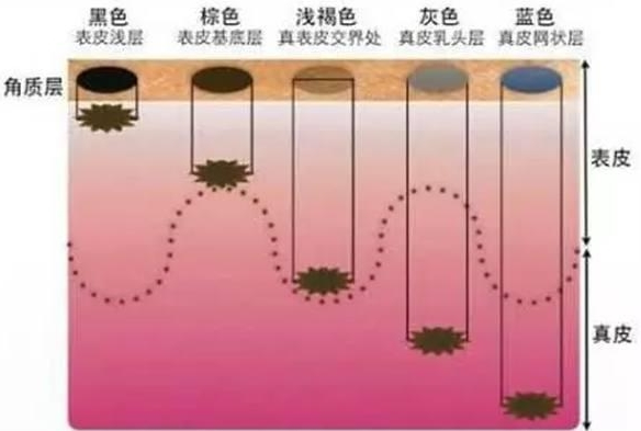 「育儿观察录」新生儿为什么会有这些青斑？真的是蒙古王子转世？真相原来是这样