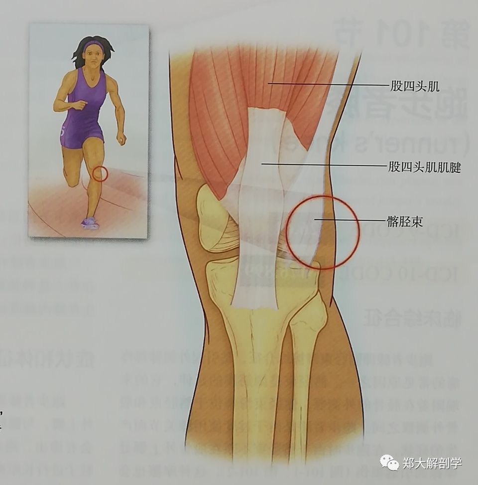 关8髌上滑囊炎髌上滑囊在股四头肌及其肌腱下方沿着髌骨下面向上延伸