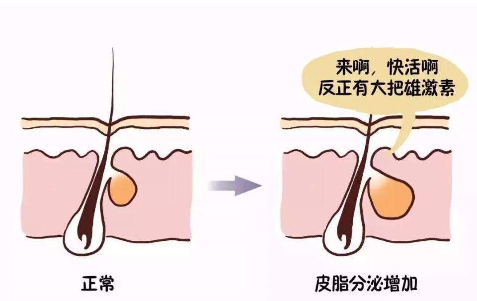 毛囊的数量从人出生就已经是一个定数 你知道自己毛囊