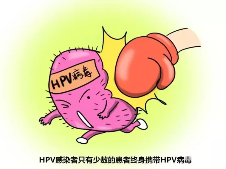 Hpv感染是什么 d66f3da05e6241948c64637e5868080b.jpeg
