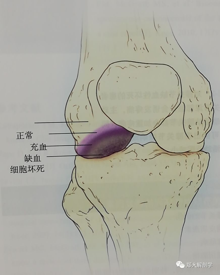 八种引起膝关节的疼痛综合征Ⅰ