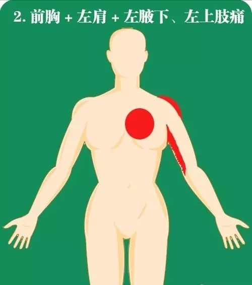 脖子背面疼 0a18b239dfa640cfafe84dc5489c54e0.jpeg