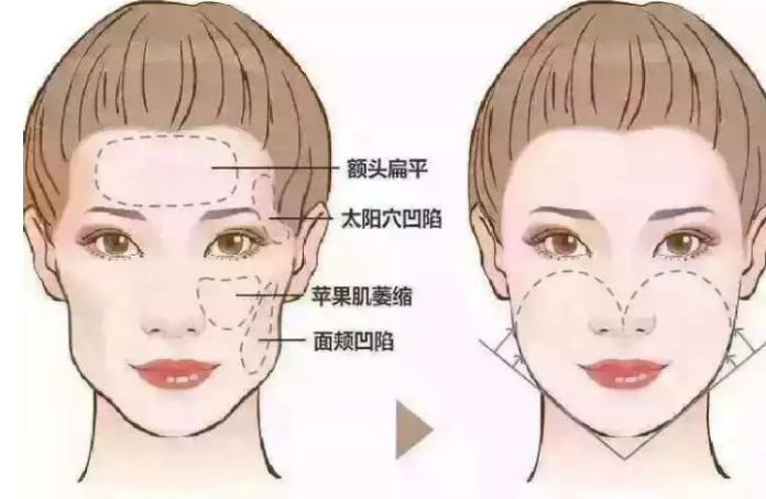 21ab7a8546ca434ab1d007d015b7631b.png