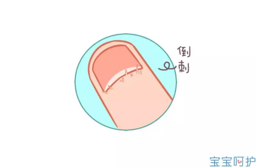 宝宝呵护：秋季宝宝小手易有倒刺，这样做家长爽但危害大