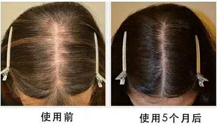 怎么才能长头发防脱发 684dc4c3fb1a412080f05c4f2247bd4f.jpeg