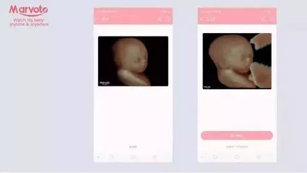 彩超排名_心脏彩超图片(2)