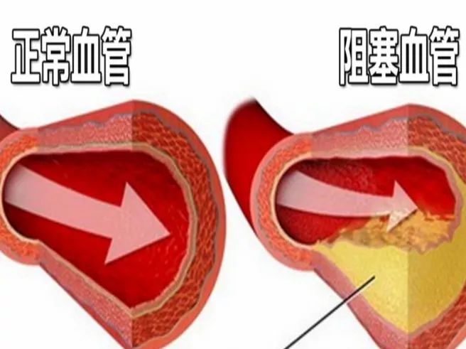 血脂怎样才能检测出来 76db9bbaef604939b4afa29465c18efc.jpeg