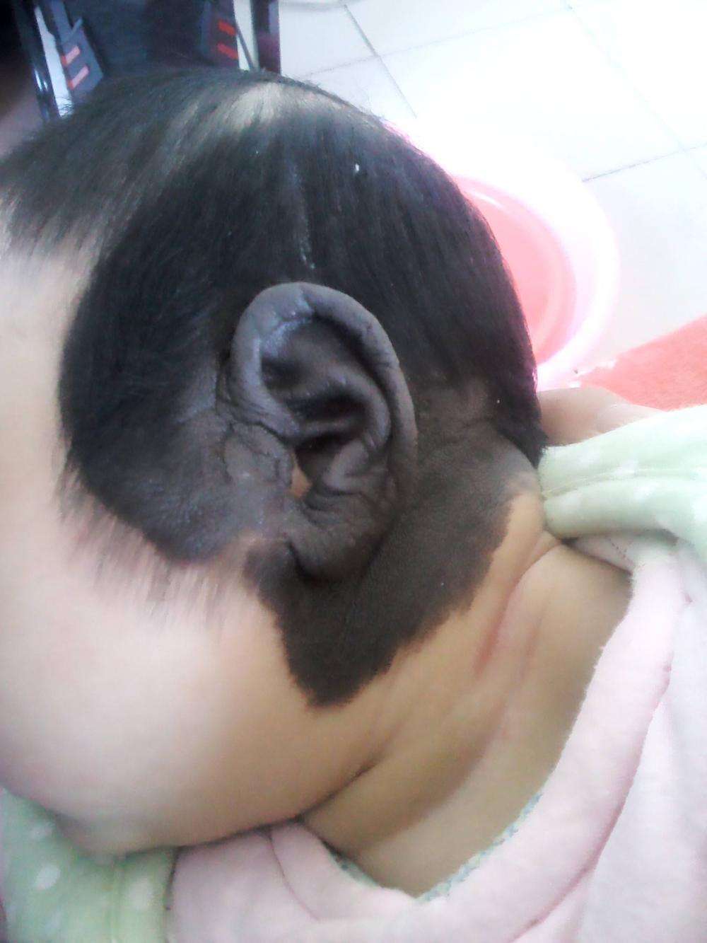 为什么会有胎记 79936d37c11b4dfc879c266eac923d93.jpeg